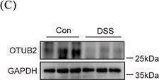 Colonic expression OTUB2 is downregulated in colitis. (A) Representative immunohistochemical staining of OTUB2 in control and UC colon samples. Scale bar = 50 um. (B) Representative immunohistochemical staining of OTUB2 in colon samples from control and DSS‐treated C57BL/6 mice. Control mice received regular drinking water. Mice in the DSS group were given 2% DSS for 8 days, followed by regular drinking water for 2 days. Scale bar = 50 um. (C, D) Representative immunoblots (C) and relative quantification (D) of OTUB2 protein in colon samples from control and DSS‐treated C57BL/6 mice. (E) Relative mRNA levels of Otub2 in colon samples from control and DSS‐treated C57BL/6 mice were analysed by qRT‐PCR. (F) Western blot analysis of OTUB2 protein abundance in colon samples from Otub2+/+ and Otub2–/– mice. (G) The representative image (left) and length (right) of colons from Otub2+/+ and Otub2–/– mice. (H, I) Representative H&E (H) and PAS/AB (I) staining of colons from Otub2+/+ and Otub2–/– mice. Scale bar = 50 um. Data in D, E and G are shown as mean +/- SEM. ns, no significant difference. *p < .05, **p < .01. Image collected and cropped by CiteAb from the following open publication (//pubmed.ncbi.nlm.nih.gov/39358938), licensed under a CC-BY license. Not internally tested by Novus Biologicals.
