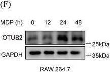 OTUB2 enhances MDP‐induced cytokine production in macrophages. (A, B) Representative OTUB2 (red) and F4/80 (green) immunofluorescence staining of colon samples from humans (A) and mice (B). Scale bar = 100 um. (C, D) BMDM isolated from C57BL/6 mice were stimulated with 500 ng/mL LPS (C) or 200 ng/mL L18‐MDP (D) for indicated periods of time. OTUB2 protein levels were then analysed by Western blot. (E) BMDM isolated from C57BL/6 mice were stimulated with 200 ng/mL L18‐MDP for indicated periods of time. The relative mRNA levels of Otub2 were determined by qRT‐PCR. Data are presented as the relative increase over untreated control samples. (F) RAW264.7 cells were stimulated with 200 ng/mL L18‐MDP for indicated periods of time. OTUB2 protein levels were then analysed by Western blot. (G–K) BMDMs isolated from Otub2+/+ and Otub2–/– mice were stimulated with 200 ng/mL L18‐MDP for 3 h or left untreated. The relative expression of Ilb (G), Il6 (H), Tnf (I), Cxcl2 (J) and Cxcl10 (K) mRNA was determined by qRT‐PCR. Data are presented as the relative increase over untreated control samples. Data in E and G–K are displayed as mean +/- SEM. *p < .05, **p < .01, ***p < .001. Image collected and cropped by CiteAb from the following open publication (//pubmed.ncbi.nlm.nih.gov/39358938), licensed under a CC-BY license. Not internally tested by Novus Biologicals.