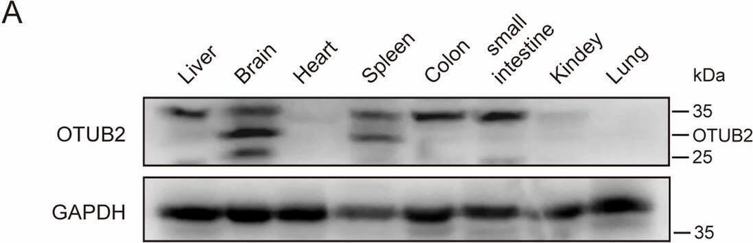 OTUB2 deficiency attenuates MCAO-induced cerebral injury.(A) OTUB2 expression in indicated organs of C57BL/6 mice was determined by Western blot. (B) OTUB2 expression in the brain of Otub2+/+ and Otub2−/− mice was analyzed by Western blot (left panel). The right panel shows the relative quantification normalized to GAPDH. Unpaired Student’s t test, n = 6/group, biological replicates. (C, D) Brains of 8-week-old male Otub2+/+ and Otub2−/− mice were analyzed by H&E (C) and Nissl (D) staining. (E) After MCAO surgery, cerebral infarct size was analyzed by TTC staining. (F) Cerebral infarct volume was calculated based on TTC staining. Two-way ANOVA, n = 5/group, biological replicates. (G–K) Neurological function was evaluated by mNSS test (G), rotarod test (H), corner turning test (I), and adhesive removal test (J, K). Two-way ANOVA, n = 5–8/group, biological replicates. Data in (B, F, G–K) show the mean +/- SEM. Source data are available online for this figure. Image collected and cropped by CiteAb from the following open publication (//pubmed.ncbi.nlm.nih.gov/40021931), licensed under a CC-BY license. Not internally tested by Novus Biologicals.