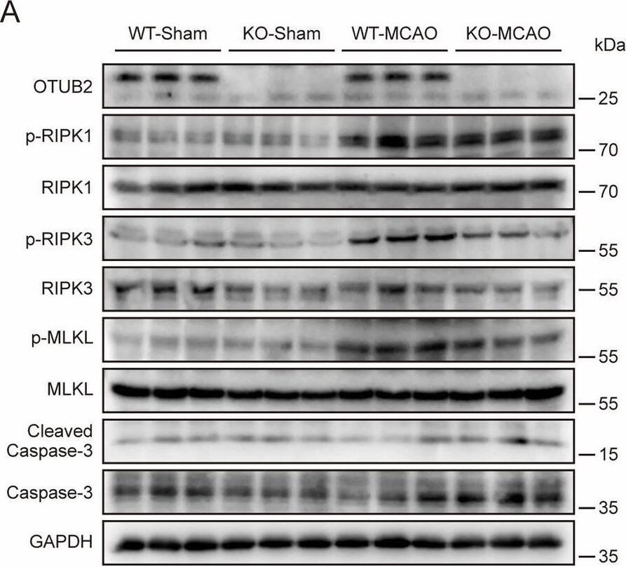 OTUB2 deficiency ameliorates RIPK3-mediated neuronal necroptosis.(A–G) Four hours after MCAO, the ischemic cerebral hemisphere was analyzed by Western blot with indicated antibodies. Representative immunoblots (A) as well as relative quantification of p-RIPK1 (B), p-RIPK3 (C), p-MLKL (D), RIPK1 (E), RIPK3 (F), and MLKL (G) are shown. Two-way ANOVA, n = 3/group, biological replicates. (H, I) Four hours after MCAO, the ischemic penumbra was analyzed by immunofluorescence with indicated antibodies. Representative images (H) and percentages of p-MLKL+ neurons (I) are shown. Scale bar, 100 μm. Unpaired Student’s t test, n = 3/group, biological replicates. (J–L) Four hours after MCAO, the relative transcription of Il1b (J), Il6 (K), and Tnf (L) in the ischemic cerebral hemisphere was determined by qRT-PCR. Unpaired Student’s t test, n = 3–5/group, biological replicates. (M, N) Representative TTC staining (M) and percentages of cerebral infarct volume (N) on day 1 after MCAO. Unpaired Student’s t test, n = 5/group, biological replicates. (O) Otub2+/+ and Otub2−/− HT22 cells were subjected to OGD for 6 h followed by reoxygenation for 12 h in the presence or absence of Nec-1 (50 μM). Cell viability was measured by CCK-8 test. Two-way ANOVA, n = 10/group, biological replicates. (P) Otub2+/+ and Otub2−/− HT22 cells were subjected to OGD for 6 h followed by reoxygenation for 12 h. Whole-cell lysates were analyzed by Western blot with indicated antibodies. (Q) After OGD treatment for 6 h followed by reoxygenation for 12 h, Otub2+/+ and Otub2−/− HT22 cells were analyzed by immunofluorescence with indicated antibodies. Scale bar, 20 μm. Data in (B–G, I, J–L, N, O) show the mean +/- SEM. Source data are available online for this figure. Image collected and cropped by CiteAb from the following open publication (//pubmed.ncbi.nlm.nih.gov/40021931), licensed under a CC-BY license. Not internally tested by Novus Biologicals.