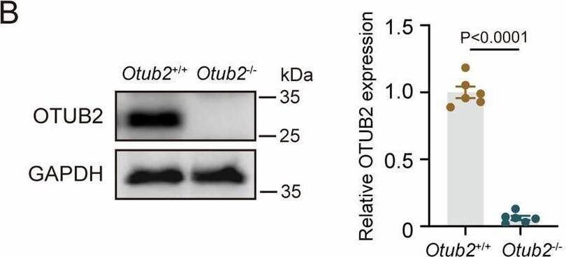 OTUB2 deficiency attenuates MCAO-induced cerebral injury.(A) OTUB2 expression in indicated organs of C57BL/6 mice was determined by Western blot. (B) OTUB2 expression in the brain of Otub2+/+ and Otub2−/− mice was analyzed by Western blot (left panel). The right panel shows the relative quantification normalized to GAPDH. Unpaired Student’s t test, n = 6/group, biological replicates. (C, D) Brains of 8-week-old male Otub2+/+ and Otub2−/− mice were analyzed by H&E (C) and Nissl (D) staining. (E) After MCAO surgery, cerebral infarct size was analyzed by TTC staining. (F) Cerebral infarct volume was calculated based on TTC staining. Two-way ANOVA, n = 5/group, biological replicates. (G–K) Neurological function was evaluated by mNSS test (G), rotarod test (H), corner turning test (I), and adhesive removal test (J, K). Two-way ANOVA, n = 5–8/group, biological replicates. Data in (B, F, G–K) show the mean +/- SEM. Source data are available online for this figure. Image collected and cropped by CiteAb from the following open publication (//pubmed.ncbi.nlm.nih.gov/40021931), licensed under a CC-BY license. Not internally tested by Novus Biologicals.