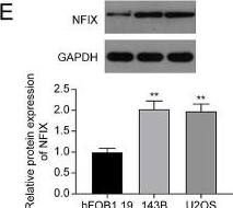miR-744-5p directly targets NFIX. (A) TargetScan, DIANA-Tarbase, and starBase algorithms were applied to identify potential downstream targets of miR-744-5p. (B) NFIX mRNA expression in OS cells transfected with miR-744-5p mimics. (C) Wild type and mutant binding sequences of miR-744-5p on NFIX. The direct binding was verified by dual-luciferase reporter assay. (D) NFIX protein expression in OS cells transfected with miR-744-5p mimics and miR-744-5p inhibitor. (E) NFIX protein expression in OS cells. ** P < 0.01 Image collected and cropped by CiteAb from the following open publication (//josr-online.biomedcentral.com/articles/10.1186/s13018-024-04947-x), licensed under a CC-BY license. Not internally tested by Novus Biologicals.