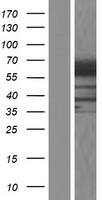 Western Blot:RIC8B Overexpression Lysate[NBP2-06860]