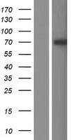 Western Blot:L3MBTL4 Overexpression Lysate[NBP2-05137]