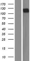 Western Blot:CD117/c-kit Overexpression Lysate[NBP2-11157]