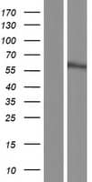 Western Blot UBXN7 Overexpression Lysate