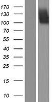 Western Blot:FGFR2 Overexpression Lysate[NBP2-04149]