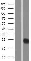 Western Blot:CTLA-4 Overexpression Lysate[NBP2-07774]