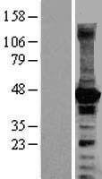 Western Blot:ARPC3 Overexpression Lysate[NBP2-04298]