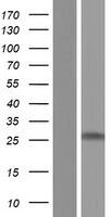 Western Blot:MBP Overexpression Lysate[NBP2-11221]
