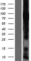 Western Blot:GFPT1 Overexpression Lysate[NBP2-08150]