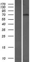 Western Blot:BTBD9 Overexpression Lysate[NBP2-08270]