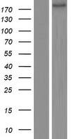 Western Blot:MAP2 Overexpression Lysate[NBP2-08120]