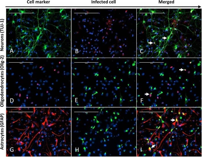 Representative fields of chicken neural cells infected with NDV TxGB strain, 12 hpi (MOI = 10). The same field (400×) was captured for each row and DAPI (pseudo-colored blue) is used for nuclear staining in all images. The first column of each row shows the cells stained for the respective cellular marker: a Tuj-1 for neurons (pseudo-colored green), d Olig-2 for oligodendrocytes (pseudo-colored red), and g GFAP for astrocytes (pseudo-colored red). The second column of each row shows the immunoreactivity for NDV in the same filed: b NDV-AP (pseudo-colored red), e NDV-BM (pseudo-colored green), and h NDV-BM (pseudo-colored green). The third column of each row (c, f, and i) shows the merged images from the first and second columns to demonstrate the colocalization of NDV and the respective cellular markers. c Double IFA signal shows cytoplasmic colocalization of the Tuj-1 and NDV fluorescent signals in scattered cells (white arrows). f Double IFA signal shows nuclear (Olig-2) and cytoplasmic (NDV-BM) colocalization of the fluorescent signal in scattered cells (white arrows). i Double IFA signal shows cytoplasmic colocalization of the GFAP and NDV fluorescent signals in scattered cells (white arrows) Image collected and cropped by CiteAb from the following open publication (//pubmed.ncbi.nlm.nih.gov/31484573), licensed under a CC-BY license. Not internally tested by Novus Biologicals.