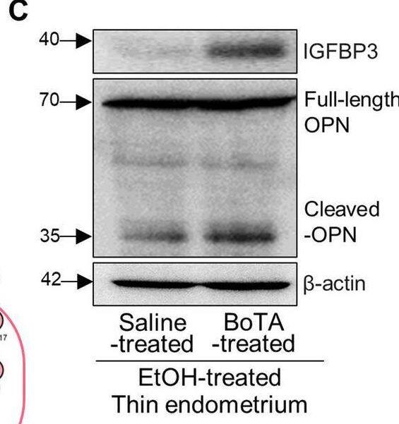 BoTA-induced endometrial regeneration mediated by IGFBP3-dependent OPN proteolytic cleavage in a thin endometrium mouse model A Venn diagram of DEGs from EtOH-treated vs. saline-treated uteri (GSE207379) and BoTA-treated vs. saline-treated (GSE146934) displaying a shared gene with a reciprocal expression; Igfbp3. B Gene–gene network analysis of DEGs of EtOH-treated vs. saline-treated uteri categorized in CC GO terms displaying a shared gene; Spp1C Immunoblotting analysis of IGFBP3 and OPN in BoTA-treated thin endometrium compared to saline-treated group. D Immunoblotting analysis of OPN in BoTA-treated thin endometrium compared to IGFBP3-treated thin endometrium.  beta -actin was used as a loading control. E An experimental schedule for an application of IGFBP3 neutralizing antibody together with BoTA. F Immunoblotting analysis of IGFBP3 and OPN in response to IGFBP3 neutralizing antibody treatment.  beta -actin was used as a loading control. G Immunostaining of IGFBP3 in saline-treated, BoTA-treated, and BoTA with IGFBP-3 neutralizing antibody-treated thin endometrium. Upper panel shows the expression of IGFBP3 in the whole region of uterus and the indicated region with a box is magnified in lower panel. Scale bar; 100 um. H Immunostaining of active-OPN in saline-treated, BoTA-treated, and BoTA with IGFBP3 neutralizing antibody-treated thin endometrium. Upper panel shows the expression of active-OPN in the whole region of uterus and the indicated regions (LE luminal epithelium, GE glandular epithelium) with boxes are magnified in lower panel. Scale bar: 100 um. I H&E images for saline-, BoTA-, and BoTA with IGFBP3 neutralizing antibody-treated uteri. Scale bar: 100 um Image collected and cropped by CiteAb from the following open publication (//pubmed.ncbi.nlm.nih.gov/36602651), licensed under a CC-BY license. Not internally tested by Novus Biologicals.