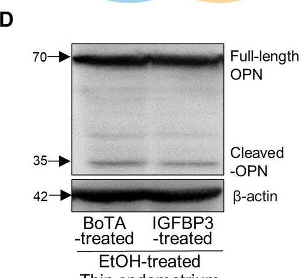 BoTA-induced endometrial regeneration mediated by IGFBP3-dependent OPN proteolytic cleavage in a thin endometrium mouse model A Venn diagram of DEGs from EtOH-treated vs. saline-treated uteri (GSE207379) and BoTA-treated vs. saline-treated (GSE146934) displaying a shared gene with a reciprocal expression; Igfbp3. B Gene–gene network analysis of DEGs of EtOH-treated vs. saline-treated uteri categorized in CC GO terms displaying a shared gene; Spp1C Immunoblotting analysis of IGFBP3 and OPN in BoTA-treated thin endometrium compared to saline-treated group. D Immunoblotting analysis of OPN in BoTA-treated thin endometrium compared to IGFBP3-treated thin endometrium.  beta -actin was used as a loading control. E An experimental schedule for an application of IGFBP3 neutralizing antibody together with BoTA. F Immunoblotting analysis of IGFBP3 and OPN in response to IGFBP3 neutralizing antibody treatment.  beta -actin was used as a loading control. G Immunostaining of IGFBP3 in saline-treated, BoTA-treated, and BoTA with IGFBP-3 neutralizing antibody-treated thin endometrium. Upper panel shows the expression of IGFBP3 in the whole region of uterus and the indicated region with a box is magnified in lower panel. Scale bar; 100 um. H Immunostaining of active-OPN in saline-treated, BoTA-treated, and BoTA with IGFBP3 neutralizing antibody-treated thin endometrium. Upper panel shows the expression of active-OPN in the whole region of uterus and the indicated regions (LE luminal epithelium, GE glandular epithelium) with boxes are magnified in lower panel. Scale bar: 100 um. I H&E images for saline-, BoTA-, and BoTA with IGFBP3 neutralizing antibody-treated uteri. Scale bar: 100 um Image collected and cropped by CiteAb from the following open publication (//pubmed.ncbi.nlm.nih.gov/36602651), licensed under a CC-BY license. Not internally tested by Novus Biologicals.
