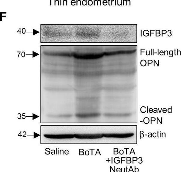 BoTA-induced endometrial regeneration mediated by IGFBP3-dependent OPN proteolytic cleavage in a thin endometrium mouse model A Venn diagram of DEGs from EtOH-treated vs. saline-treated uteri (GSE207379) and BoTA-treated vs. saline-treated (GSE146934) displaying a shared gene with a reciprocal expression; Igfbp3. B Gene–gene network analysis of DEGs of EtOH-treated vs. saline-treated uteri categorized in CC GO terms displaying a shared gene; Spp1C Immunoblotting analysis of IGFBP3 and OPN in BoTA-treated thin endometrium compared to saline-treated group. D Immunoblotting analysis of OPN in BoTA-treated thin endometrium compared to IGFBP3-treated thin endometrium.  beta -actin was used as a loading control. E An experimental schedule for an application of IGFBP3 neutralizing antibody together with BoTA. F Immunoblotting analysis of IGFBP3 and OPN in response to IGFBP3 neutralizing antibody treatment.  beta -actin was used as a loading control. G Immunostaining of IGFBP3 in saline-treated, BoTA-treated, and BoTA with IGFBP-3 neutralizing antibody-treated thin endometrium. Upper panel shows the expression of IGFBP3 in the whole region of uterus and the indicated region with a box is magnified in lower panel. Scale bar; 100 um. H Immunostaining of active-OPN in saline-treated, BoTA-treated, and BoTA with IGFBP3 neutralizing antibody-treated thin endometrium. Upper panel shows the expression of active-OPN in the whole region of uterus and the indicated regions (LE luminal epithelium, GE glandular epithelium) with boxes are magnified in lower panel. Scale bar: 100 um. I H&E images for saline-, BoTA-, and BoTA with IGFBP3 neutralizing antibody-treated uteri. Scale bar: 100 um Image collected and cropped by CiteAb from the following open publication (//pubmed.ncbi.nlm.nih.gov/36602651), licensed under a CC-BY license. Not internally tested by Novus Biologicals.