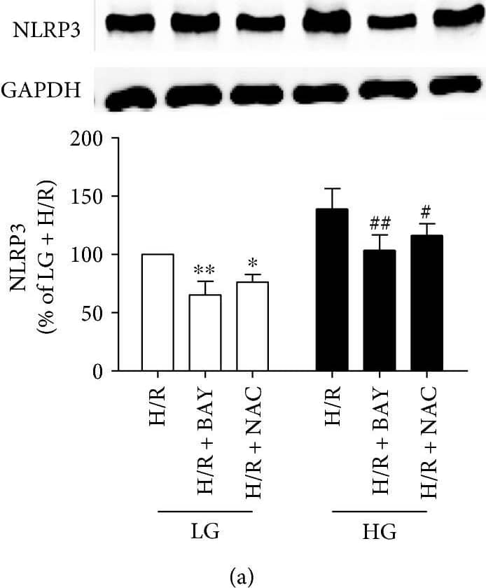 Western Blot: NLRP3/NALP3 Antibody - BSA Free [NBP2-12446] - The ROS scavenger inhibited the activation of NLRP3 inflammasomes in H9C2 cells exposed to H/R injury. The expression levels of NLRP3 (a), ASC (b), procaspase-1 & caspase-1 (p10) (c), & IL-1 beta  (d) were detected by Western blot. Data are expressed as the mean ± SD. n = 5 per group. ∗P < 0.05 & ∗∗P < 0.01 versus LG + H/R; #P < 0.05 & ##P < 0.01 versus HG + H/R. Image collected & cropped by CiteAb from the following publication (//pubmed.ncbi.nlm.nih.gov/29062465), licensed under a CC-BY license. Not internally tested by Novus Biologicals.