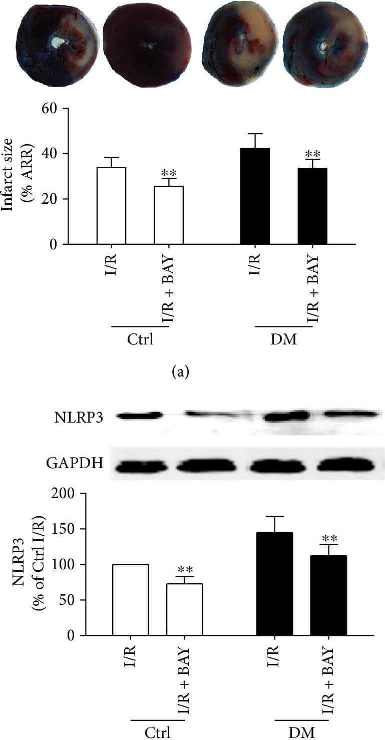 Western Blot: NLRP3/NALP3 Antibody - BSA Free [NBP2-12446] - The inflammasome inhibitor reduced the myocardial infarct size & decreased activation of the NLRP3 inflammasome, IL-1 beta , & caspase-1 (p10) in nondiabetic & diabetic rats after MI/R. The infarct size was detected by TTC staining (a). The CK-MB activities were determined by enzyme activity assay kits (b). The expression of NLRP3 (c), ASC (d), procaspase-1 & caspase-1 (e), & IL-1 beta  (f) was analyzed by Western blot as shown. Data are expressed as the mean ± SD. n = 6 to 8. ∗∗P < 0.01 versus IR. Image collected & cropped by CiteAb from the following publication (//pubmed.ncbi.nlm.nih.gov/29062465), licensed under a CC-BY license. Not internally tested by Novus Biologicals.