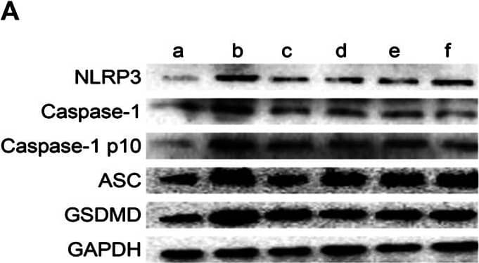 Western Blot: NLRP3/NALP3 Antibody - BSA Free [NBP2-12446] - Effect of Taohong Siwu decoction (THSWD) on the characteristic protein of pyroptosis in middle cerebral artery occlusion-reperfusion (MCAO/R) rats. (A) Photographs of western blots, (B) NLRP3, (C) Caspase-1, (D) Caspase-1 p10, (E) ASC, (F) GSDMD. a: Sham, b: Model, c: THSWD (18 g/kg), d: THSWD (9 g/kg), e: THSWD (4.5 g/kg), f: nimodipine. The results were presented as the mean ± SD (n = 3). Compared with sham group, #p < 0.05, ##p < 0.01. Compared with model group, *p < 0.05, **p < 0.01. Image collected & cropped by CiteAb from the following publication (//pubmed.ncbi.nlm.nih.gov/33424599), licensed under a CC-BY license. Not internally tested by Novus Biologicals.