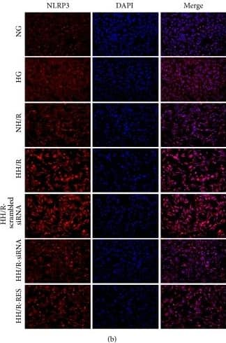Immunocytochemistry/ Immunofluorescence: NLRP3/NALP3 Antibody - BSA Free [NBP2-12446] - Immunofluorescence staining of TXNIP (a) & NLRP3 (b). NG: normal glucose (5.6 mM); HG: high glucose (30 mM). NH/R: hypoxia (4 h)/reoxygenation (2 h) under NG conditions; HH/R: hypoxia (4 h)/reoxygenation (2 h) under HG conditions. HH/R-RES: HH/R pretreated by RES (50 μM) for 72 h with the high glucose incubation. HH/R-siRNA: TXNIP protein was inhibited by transfection with TXNIP siRNA before HH/R; HH/R-scrambled siRNA: scrambled siRNA used as control before HH/R. Image collected & cropped by CiteAb from the following publication (//pubmed.ncbi.nlm.nih.gov/27867451), licensed under a CC-BY license. Not internally tested by Novus Biologicals.