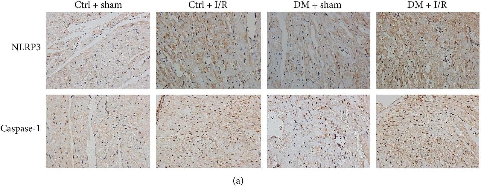 Immunohistochemistry-Paraffin: NLRP3/NALP3 Antibody - BSA Free [NBP2-12446] - The activation of the NLRP3 inflammasome & expression of caspase-1 & IL-1 beta  were increased in diabetic rats after MI/R insult. NLRP3 & caspase-1 expression in heart tissues were examined by immunohistochemistry (a). The expression of NLRP3 (b), ASC (c), procaspase-1 & caspase-1 (d), & IL-1 beta  (e) were analyzed by Western blot. Data are expressed as the mean ± SD. n = 8. ∗∗P < 0.01 versus sham; #P < 0.05 versus Ctrl + sham; & ##P < 0.01 versus Ctrl + I/R. Image collected & cropped by CiteAb from the following publication (//pubmed.ncbi.nlm.nih.gov/29062465), licensed under a CC-BY license. Not internally tested by Novus Biologicals.