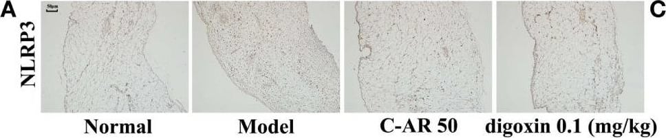 Immunohistochemistry: NLRP3/NALP3 Antibody - BSA Free [NBP2-12446] - C-AR inhibited NLRP3 inflammasome activation in synovial tissue. (A,B) Immunohistochemistry staining of NLRP3 expression (A) & cleaved caspase-1 activation (B) in the synovial tissue of collagen-induced arthritis (CIA) rats (original magnification, 100 × ; scale bar, 50 μm). (C,D) IL-1 beta  in the synovial tissue of CIA rats (C) & TGF-beta 1-stimulated synovial fibroblasts (D) were measured by ELISA Kits (n = 6); (E) NLRP3 protein expression in succinate-stimulated synovial fibroblasts. The results were derived from four independent experiments for immunohistochemistry staining & Western blot & expressed as the mean ± SD. *p < 0.05 vs. the model; #p < 0.05 vs. the indicated treatment. Image collected & cropped by CiteAb from the following publication (//journal.frontiersin.org/article/10.3389/fimmu.2016.00532/full), licensed under a CC-BY license. Not internally tested by Novus Biologicals.