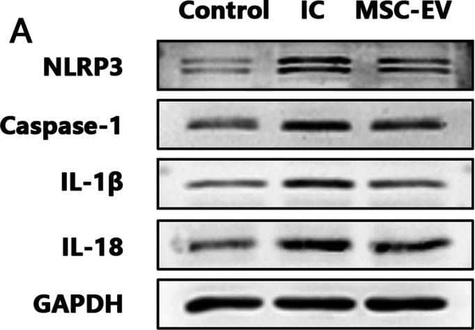 Western Blot: NLRP3/NALP3 Antibody - BSA Free [NBP2-12446] - MSC-EVs inhibit activity of NLRP3 inflammasome in SDH of IC rats. A–E Western blot analysis showing that intrathecal injection of MSC-EVs significantly decreased expression levels of NLRP3, Caspase-1, IL-1 beta  & IL-18 in SDH of IC rats. n = 8 per group. *P < 0.05 Image collected & cropped by CiteAb from the following publication (//pubmed.ncbi.nlm.nih.gov/35387668), licensed under a CC-BY license. Not internally tested by Novus Biologicals.