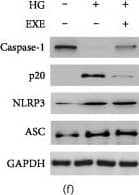 Western Blot: NLRP3/NALP3 Antibody - BSA Free [NBP2-12446] - Exendin-4 inhibits diabetic cardiomyocyte pyroptosis: (a) immunohistochemistry of NLRP3, cleaved caspase-1, IL-1 beta , & IL-18 in the myocardium; (b, c) transcriptional activity of caspase-1 & NLRP3 in the heart (n = 3); (d, e) IL-1 beta  & IL-18 ELISA with supernatant of cardiomyocyte culture medium; (f) Western blot of pyroptotic proteins; (g) caspase-1 activity assay (n = 3); (h) FLICA staining in cardiomyocytes. Upper panels showed the fluorescent images of CON, HG, & HG+EXE cardiomyocytes. The lower panel is a statistic of the enrichment of FLICA emitting fluorescence in single cells (n = 10). Image collected & cropped by CiteAb from the following publication (//pubmed.ncbi.nlm.nih.gov/31886288), licensed under a CC-BY license. Not internally tested by Novus Biologicals.