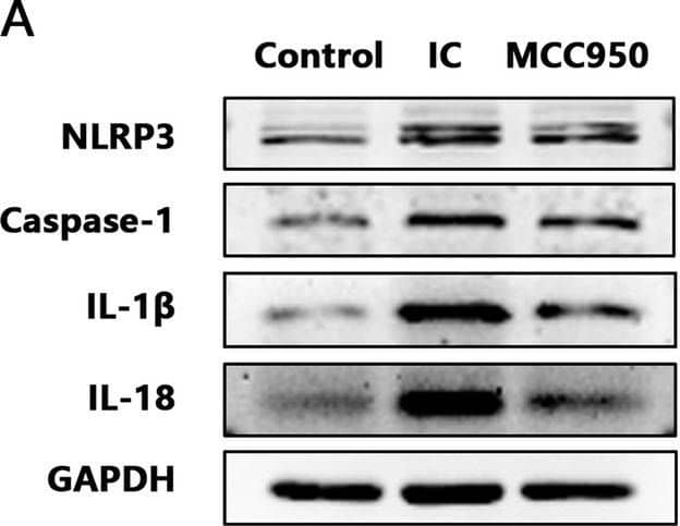 Western Blot: NLRP3/NALP3 Antibody - BSA Free [NBP2-12446] - NLRP3 inflammasome is activated in neurons in SDH of IC rats, & MCC950 inhibits the NLRP3 inflammasome activation. A–E Western blot analysis showing that expression levels of NLRP3, Caspase-1, IL-1 beta  & IL-18 were significantly increased in SDH of IC rats compared with normal rats, & MCC950 treatment significantly decreased expression levels of NLRP3, Caspase-1, IL-1 beta  & IL-18 in SDH of IC rats. n = 8 per group. *P < 0.05. F Immunofluorescence co-staining showing that NLRP3 was colocalized predominantly with NeuN (neuron marker), but scarcely with GFAP (astrocyte marker) or OX-42 (microglia marker) in the SDH. Scale bars = 200 μm Image collected & cropped by CiteAb from the following publication (//pubmed.ncbi.nlm.nih.gov/35387668), licensed under a CC-BY license. Not internally tested by Novus Biologicals.