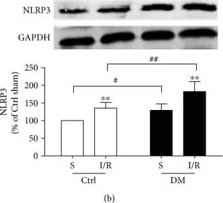 Western Blot: NLRP3/NALP3 Antibody - BSA Free [NBP2-12446] - The activation of the NLRP3 inflammasome & expression of caspase-1 & IL-1 beta  were increased in diabetic rats after MI/R insult. NLRP3 & caspase-1 expression in heart tissues were examined by immunohistochemistry (a). The expression of NLRP3 (b), ASC (c), procaspase-1 & caspase-1 (d), & IL-1 beta  (e) were analyzed by Western blot. Data are expressed as the mean ± SD. n = 8. ∗∗P < 0.01 versus sham; #P < 0.05 versus Ctrl + sham; & ##P < 0.01 versus Ctrl + I/R. Image collected & cropped by CiteAb from the following publication (//pubmed.ncbi.nlm.nih.gov/29062465), licensed under a CC-BY license. Not internally tested by Novus Biologicals.
