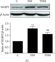Western Blot: NLRP3/NALP3 Antibody - BSA Free [NBP2-12446] - Hippocampal AMPK/Sirt1 & NF kappa B/NLRP3/IL-1 beta  signaling pathways in diabetic rats & the effects of aerobic exercise. Type 2 diabetes significantly decreases the activation of hippocampal AMPK (a) & the level of Sirt1 (c), leading to increased Ac-NF kappa B (d) & NF kappa B (e); diabetic rats contain more NLRP3 inflammasomes (f) & IL-1 beta  (g). Aerobic exercise intervention significantly increases AMPK activity & Sirt1 concentration; aerobic exercise downregulates the Ac-NF kappa B & NF kappa B, leading to decreased levels of the NLRP3 inflammasome & IL-1 beta . ∗∗p < 0.01, DM group vs. C group; #p < 0.05, TDM group vs. DM group. Image collected & cropped by CiteAb from the following publication (//pubmed.ncbi.nlm.nih.gov/30911292), licensed under a CC-BY license. Not internally tested by Novus Biologicals.