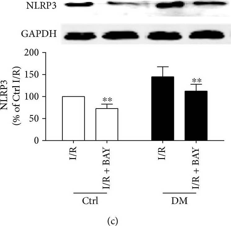Western Blot: NLRP3/NALP3 Antibody - BSA Free [NBP2-12446] - The inflammasome inhibitor reduced the myocardial infarct size & decreased activation of the NLRP3 inflammasome, IL-1 beta , & caspase-1 (p10) in nondiabetic & diabetic rats after MI/R. The infarct size was detected by TTC staining (a). The CK-MB activities were determined by enzyme activity assay kits (b). The expression of NLRP3 (c), ASC (d), procaspase-1 & caspase-1 (e), & IL-1 beta  (f) was analyzed by Western blot as shown. Data are expressed as the mean ± SD. n = 6 to 8. ∗∗P < 0.01 versus IR. Image collected & cropped by CiteAb from the following publication (//pubmed.ncbi.nlm.nih.gov/29062465), licensed under a CC-BY license. Not internally tested by Novus Biologicals.