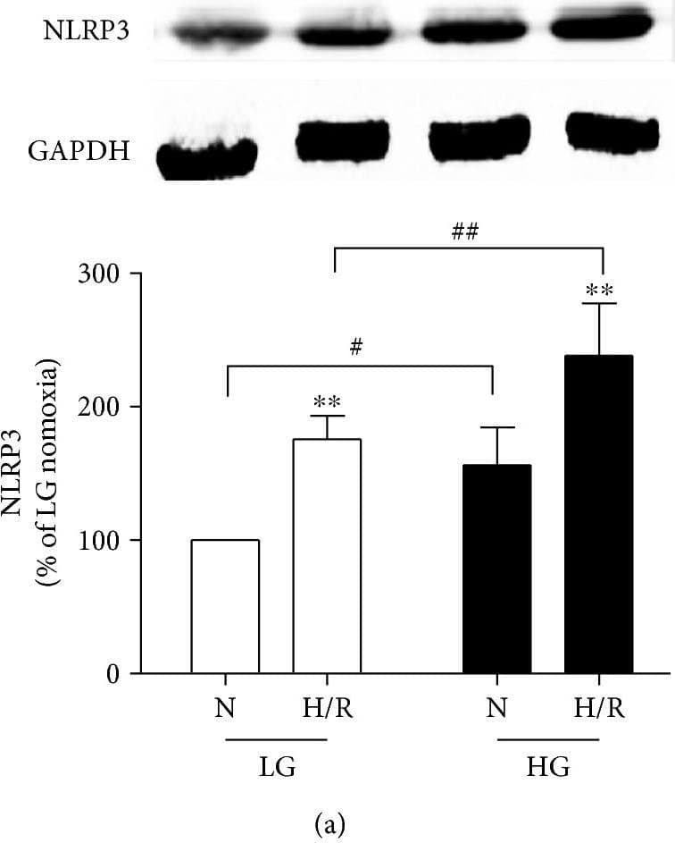 Western Blot: NLRP3/NALP3 Antibody - BSA Free [NBP2-12446] - Protein expression in HG & H/R conditions. Western blotting for NLRP3 (a), ASC (b), procaspase-1 & caspase-1 (p10) (c), & IL-1 beta  (d) in H9C2 cells. Data are expressed as the mean ± SD. n = 5 per group. ∗∗P < 0.01 versus N; #P < 0.01 versus LG; & ##P < 0.01 versus LG + H/R. Image collected & cropped by CiteAb from the following publication (//pubmed.ncbi.nlm.nih.gov/29062465), licensed under a CC-BY license. Not internally tested by Novus Biologicals.