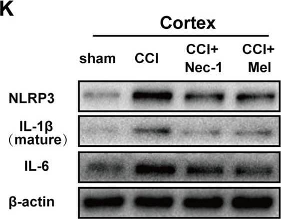 Western Blot: NLRP3/NALP3 Antibody - BSA Free [NBP2-12446] - Downstream receptor for advanced glycation end-products (RAGE) & nuclear factor (NF)-kappa B pathway were inhibited after treatment of Nec-1 & melatonin. NF-kappa B pathway was detected by immunoblotting in the cortex (A–E) & hippocampus CA1 (F–J). Relative downstream inflammatory factors were detected by immunoblotting in the cortex (K–N) & hippocampus CA1 (O–R). All experiments were performed in triplicate by one way ANOVA plus Tukey’s test. **P < 0.01 & ***P < 0.001 vs. sham group. #P < 0.05 & ##P < 0.01 vs. CCI group. Image collected & cropped by CiteAb from the following publication (//pubmed.ncbi.nlm.nih.gov/31607859), licensed under a CC-BY license. Not internally tested by Novus Biologicals.