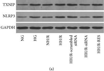 Western Blot: NLRP3/NALP3 Antibody - BSA Free [NBP2-12446] - Western blot analysis of TXNIP & NLRP3 protein expression in cultured HK-2 cells treated by normal glucose (5.5 mM), high glucose (30 mM), & NG + mannitol, respectively, for 72 hours, then following 4 hours of hypoxia & 2 hours of reoxygenation in HK-2 cells under high glucose stimulation with or without TXNIP siRNA & RES treatment, respectively. Representative blots (a) & quantitative analysis of Western blots for TXNIP (c) & NLRP3 (d), activity of caspase-1 (e), level of IL-1 beta  (f), & Western blot of TXNIP gene knockdown in HK-2 cells (b). The data in (c–f) are means ± SE (n = 5). #P < 0.05 versus NG group; ☆P < 0.05 versus NH/R group; &P < 0.05 versus HH/R-scrambled siRNA group. Image collected & cropped by CiteAb from the following publication (//pubmed.ncbi.nlm.nih.gov/27867451), licensed under a CC-BY license. Not internally tested by Novus Biologicals.