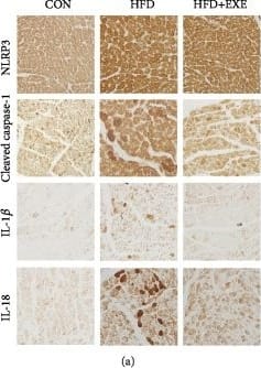 Immunohistochemistry: NLRP3/NALP3 Antibody - BSA Free [NBP2-12446] - Exendin-4 inhibits diabetic cardiomyocyte pyroptosis: (a) immunohistochemistry of NLRP3, cleaved caspase-1, IL-1 beta , & IL-18 in the myocardium; (b, c) transcriptional activity of caspase-1 & NLRP3 in the heart (n = 3); (d, e) IL-1 beta  & IL-18 ELISA with supernatant of cardiomyocyte culture medium; (f) Western blot of pyroptotic proteins; (g) caspase-1 activity assay (n = 3); (h) FLICA staining in cardiomyocytes. Upper panels showed the fluorescent images of CON, HG, & HG+EXE cardiomyocytes. The lower panel is a statistic of the enrichment of FLICA emitting fluorescence in single cells (n = 10). Image collected & cropped by CiteAb from the following publication (//pubmed.ncbi.nlm.nih.gov/31886288), licensed under a CC-BY license. Not internally tested by Novus Biologicals.