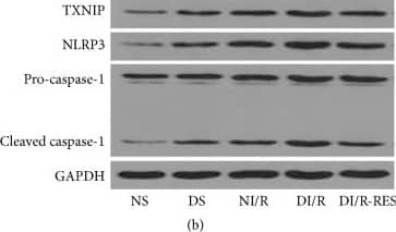 Western Blot: NLRP3/NALP3 Antibody - BSA Free [NBP2-12446] - STZ-induced diabetes induces TXNIP expression & NLRP3 inflammasome activation following I/R 48. TXNIP expression was examined by IHC (a), representative blots (b), & quantitative analysis of Western blots for TXNIP (c), NLRP3 (d) & pro-caspase-1 & cleaved caspase-1 (e-f), & release of IL-1 beta  & IL-18 by ELISA (g-h). The data in (c–h) are means ± SE (n = 5). ★P < 0.05 versus NS group; #P < 0.05 versus DS group; ▲P < 0.05 versus NI/R group; &P < 0.05 versus DI/R group. NS & DS: nondiabetic & STZ-induced diabetic rats were subjected to sham operation. NI/R & DI/R: nondiabetic & STZ-induced diabetic rats were subjected to 25 min ischemia followed by 48 h reperfusion. DI/R-RES: STZ-induced diabetic rats that underwent I/R were treated with RES (10 mg/kg, ip daily) for 7 consecutive days before renal ischemia-reperfusion. Image collected & cropped by CiteAb from the following publication (//pubmed.ncbi.nlm.nih.gov/27867451), licensed under a CC-BY license. Not internally tested by Novus Biologicals.