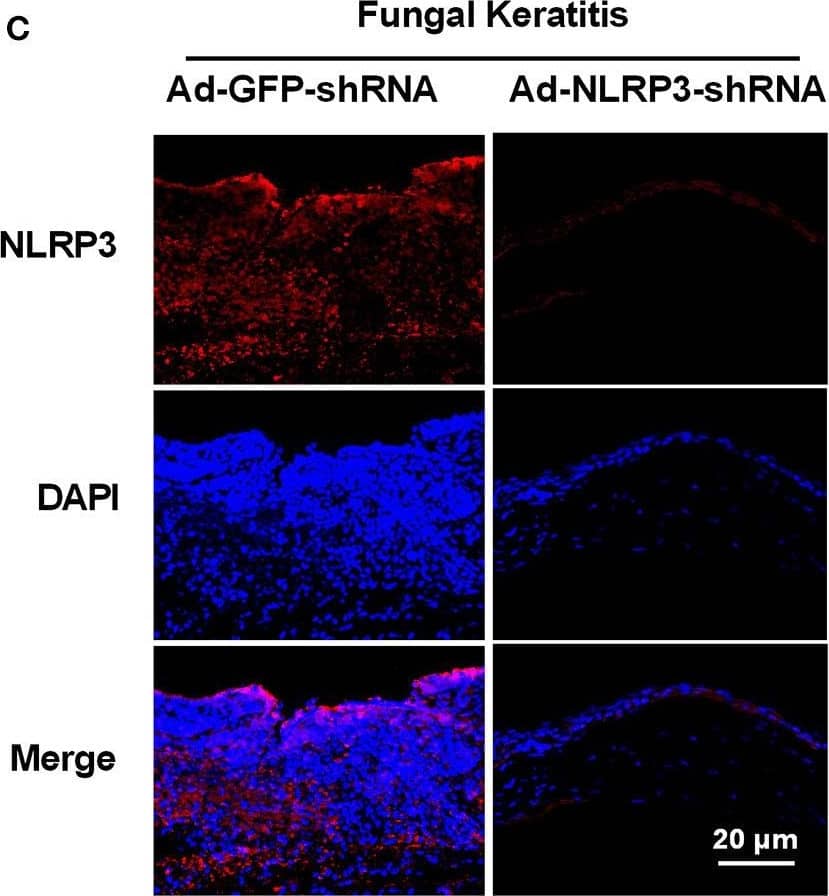 Immunocytochemistry/ Immunofluorescence: NLRP3/NALP3 Antibody - BSA Free [NBP2-12446] - NLRP3 knockdown decreases corneal inflammation & suppressed neutrophil infiltration in mouse C. albicans keratitis. The C57BL/6 mice were subconjunctivally injected with 6 μL (4 × 108 PFU) of the Ad-GFP-shRNA or Ad-NLRP3-shRNA suspension 3 days before inoculation with 1 × 106 CFU C. albicans or with 5μL sterile PBS after the corneas were scratched. The mouse corneas or eyeballs were collected at 3 dpi & subjected for further detection. RT-qPCR analysis (A), western blot (B) & immunofluorescence staining (C) were used to verify the gene knockdown efficiency of Ad-NLRP3-shRNA (n = 3). Scale bar = 20 μm; magnification 400×. (D) Micrographs of Ad-GFP-shRNA & Ad-NLRP3-shRNA-pretreated mouse corneas were photographed at 3dpi. (E) Clinical score of the infected corneas pretreated with Ad-GFP-shRNA & Ad-NLRP3-shRNA (n = 10). (F) Immunofluorescence staining was performed to assess the levels of neutrophils recruitment in mouse corneas after Ad-GFP-shRNA & Ad-NLRP3-shRNA pretreatment (n =3). Scale bar = 50 μm; magnification 200×. FK: fungal keratitis. All values are presented as mean ± SEM. **p < 0.01; ***p < 0.001. Image collected & cropped by CiteAb from the following publication (//pubmed.ncbi.nlm.nih.gov/35463001), licensed under a CC-BY license. Not internally tested by Novus Biologicals.