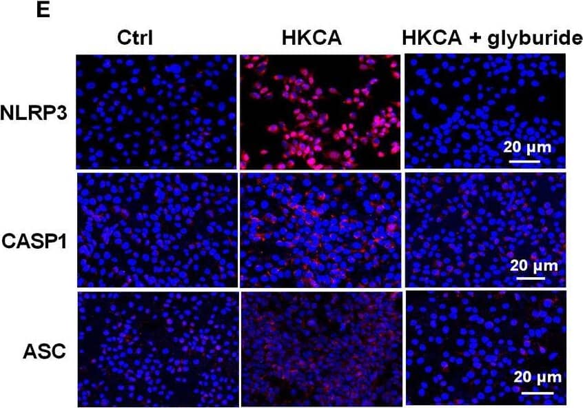 Western Blot: NLRP3/NALP3 Antibody - BSA Free [NBP2-12446] - Western blot analysis of TXNIP & NLRP3 protein expression in cultured HK-2 cells treated by normal glucose (5.5 mM), high glucose (30 mM), & NG + mannitol, respectively, for 72 hours, then following 4 hours of hypoxia & 2 hours of reoxygenation in HK-2 cells under high glucose stimulation with or without TXNIP siRNA & RES treatment, respectively. Representative blots (a) & quantitative analysis of Western blots for TXNIP (c) & NLRP3 (d), activity of caspase-1 (e), level of IL-1 beta  (f), & Western blot of TXNIP gene knockdown in HK-2 cells (b). The data in (c–f) are means ± SE (n = 5). #P 0.05; *p 0.05; *p < 0.05; **p < 0.01; ***p < 0.001; ****p < 0.0001. Image collected & cropped by CiteAb from the following publication (//pubmed.ncbi.nlm.nih.gov/35463001), licensed under a CC-BY license. Not internally tested by Novus Biologicals.