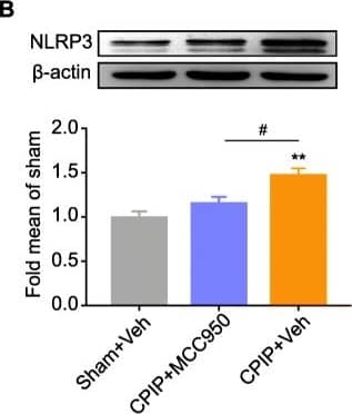 Western Blot: NLRP3/NALP3 Antibody - BSA Free [NBP2-12446] - Pharmacological blocking NLRP3 inflammasome activation attenuated the mechanical allodynia of CPIP rats. a Schematic protocol illustrating the time points for model establishment, behavioral tests, & MCC950 (30 μg/rat in 12.5 μl injection volume, via intrathecal catheter)/vehicle (0.1% DMSO in PBS) application. b NLRP3 expression in ipsilateral SCDH of Sham+Veh, CPIP+MCC950, & CPIP+Veh groups measure by Western blot. Upper panel indicates representative images of NLRP3 &  beta -actin protein expression. Lower panel indicates summarized NLRP3 expression normalized to  beta -actin. c IL-1 beta  expression in ipsilateral SCDH of Sham+Veh, CPIP+MCC950, & CPIP+Veh groups measure by Western blot. Upper panel indicates representative images of IL-1 beta  &  beta -actin protein expression. Lower panel indicates summarized IL-1 beta  expression normalized to  beta -actin. n = 4 rats/group. d Time course effect of MCC950 on 50% paw withdraw threshold (PWT) of ipsilateral hind paw of CPIP rats. e Summary of the normalized area under the curve (AUC) as in d. n = 6 rats/group. **p < 0.01 vs. Sham+Veh group. ##p < 0.01 vs. CPIP+Veh group. Two-way ANOVA followed by Tukey’s post hoc test was used for comparison in panel d. One-way ANOVA followed by Tukey’s post hoc test was used for comparison in panel e Image collected & cropped by CiteAb from the following publication (//pubmed.ncbi.nlm.nih.gov/32446302), licensed under a CC-BY license. Not internally tested by Novus Biologicals.