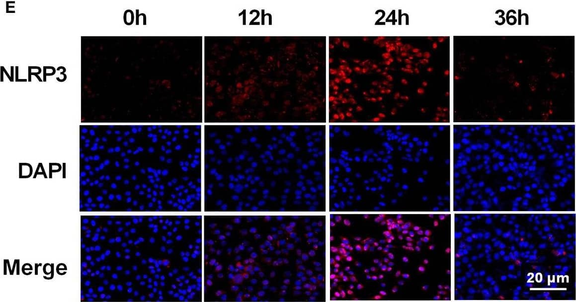 Immunocytochemistry/ Immunofluorescence: NLRP3/NALP3 Antibody - BSA Free [NBP2-12446] - Heat-killed C. albicans (HKCA) activates NLRP3 inflammasome & induces pyroptosis in human corneal epithelial cells (HCECs). (A) The mRNA expression of NLRP3 in HCECs challenged with HKCA at an MOI of 1:500, 1:50, 1:5, 2:1, or 20:1 respectively for 4 hours was evaluated by RT-qPCR (n = 5). (B–D) The mRNA & protein expression of NLRP3 in HCECs exposed to HKCA (MOI = 20) for 0 (control), 2, 4, 8, 12, or 24 h (n = 3). (E) NLRP3 fluorescence intensity was evaluated using immunofluorescent staining for different times (12–36 h). (n = 3; Scale bar = 20 μm; magnification 400×). (F) Lactate dehydrogenase (LDH) of HCECs treated with HKCA (MOI = 20) for 24 h (n = 6). (G) The mRNA levels of ASC, CASP1, IL-1 beta , IL-18 & GSDMD in HCECs exposed to HKCA (MOI = 20) for different times (n = 3). (H,I) The protein expression of pyroptosis-related proteins (ASC, cleaved CASP1, N-GSDMD, cleaved IL-1 beta  & cleaved IL-18) was examined by western blot (n = 3). CASP1: caspase-1; Clv-CASP1: cleaved CASP1; Clv-IL-1 beta : cleaved IL-1 beta ; Clv-IL-18: cleaved IL-18; N-GSDMD: cleaved p30 form of GSDMD. All values are presented as mean ± SEM. *p < 0.05; **p < 0.01; ***p < 0.001; ****p < 0.0001 vs. control group. Image collected & cropped by CiteAb from the following publication (//pubmed.ncbi.nlm.nih.gov/35463001), licensed under a CC-BY license. Not internally tested by Novus Biologicals.