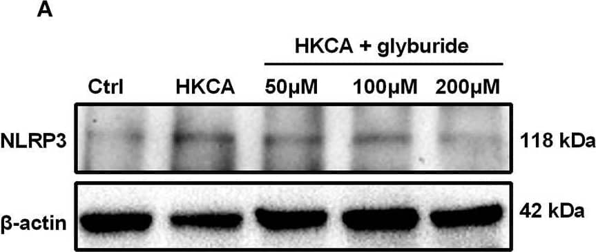 Western Blot: NLRP3/NALP3 Antibody - BSA Free [NBP2-12446] - Glyburide attenuates NLRP3 inflammasome-mediated pyroptosis in HCECs infected with HKCA. HCECs were pretreated with potassium (K+) channel inhibitor (glyburide) for 2 h, & then were incubated with HKCA (MOI = 20) for 24 h. (A,B) Western blot showing the protein levels of NLRP3 in HCECs treated with various concentrations of glyburide (50, 100 & 200 μM) (n = 3). (C,D) Glyburide treatment (200 μM) suppressed the levels of pyroptosis-related proteins (ASC, cleaved CASP1, N-GSDMD, cleaved IL-1 beta  & cleaved IL-18) in HCECs challenged with HKCA at 20:1 for 24 h (n = 3). (E) Immunofluorescence analysis of NLRP3, CASP1 & ASC in HCECs pretreated with or without glyburide (200 μM) for 24 h (n = 3). Scale bar = 20 μm; magnification 400×. (F) LDH release of HCECs treated with glyburide (200 μM) (n = 6). CASP1: caspase-1; Clv-CASP1: cleaved CASP1; Clv-IL-1 beta : cleaved IL-1 beta ; Clv-IL-18: cleaved IL-18; N-GSDMD: cleaved p30 form of GSDMD. All values are presented as mean ± SEM. N.S. P>0.05; *p < 0.05; **p < 0.01; ***p < 0.001; ****p < 0.0001. Image collected & cropped by CiteAb from the following publication (//pubmed.ncbi.nlm.nih.gov/35463001), licensed under a CC-BY license. Not internally tested by Novus Biologicals.