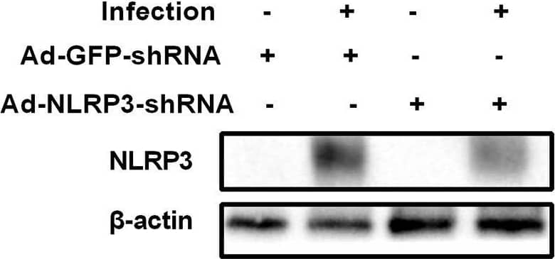 Immunocytochemistry/ Immunofluorescence: NLRP3/NALP3 Antibody - BSA Free [NBP2-12446] - NLRP3 knockdown decreases corneal inflammation & suppressed neutrophil infiltration in mouse C. albicans keratitis. The C57BL/6 mice were subconjunctivally injected with 6 μL (4 × 108 PFU) of the Ad-GFP-shRNA or Ad-NLRP3-shRNA suspension 3 days before inoculation with 1 × 106 CFU C. albicans or with 5μL sterile PBS after the corneas were scratched. The mouse corneas or eyeballs were collected at 3 dpi & subjected for further detection. RT-qPCR analysis (A), western blot (B) & immunofluorescence staining (C) were used to verify the gene knockdown efficiency of Ad-NLRP3-shRNA (n = 3). Scale bar = 20 μm; magnification 400×. (D) Micrographs of Ad-GFP-shRNA & Ad-NLRP3-shRNA-pretreated mouse corneas were photographed at 3dpi. (E) Clinical score of the infected corneas pretreated with Ad-GFP-shRNA & Ad-NLRP3-shRNA (n = 10). (F) Immunofluorescence staining was performed to assess the levels of neutrophils recruitment in mouse corneas after Ad-GFP-shRNA & Ad-NLRP3-shRNA pretreatment (n =3). Scale bar = 50 μm; magnification 200×. FK: fungal keratitis. All values are presented as mean ± SEM. **p < 0.01; ***p < 0.001. Image collected & cropped by CiteAb from the following publication (//pubmed.ncbi.nlm.nih.gov/35463001), licensed under a CC-BY license. Not internally tested by Novus Biologicals.