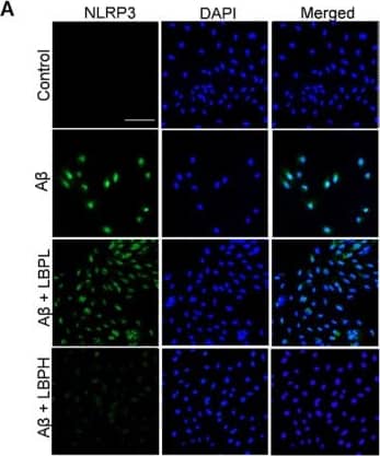 Immunocytochemistry/ Immunofluorescence: NLRP3/NALP3 Antibody - BSA Free [NBP2-12446] - Lycium barbarum polysaccharides lessened the changes in expression of pyroptosis markers (NOD-like receptors protein 3 (NLRP3), caspase-1, & membrane N-terminal cleavage product of GSDMD (GSDMD-N)) in A beta 1-40 oligomers-exposed ARPE-19 cells. (A) Representative IF images of NLRP3 (green fluorescence) & DAPI (blue fluorescence) in ARPE-19 cells under different treatments. A beta 1-40 oligomers exposure increased the cellular expressions of NLRP3 (second row). However, increased expression was subsequently decreased by LBP treatment with both low (3.5 mg/L) & high (14 mg/L) concentration (third row & the fourth row). (B) The histogram indicated the average fluorescence intensity of NLRP3 based on the IF results (n = 3, ***p < 0.001). (C) Representative IF images of caspase-1 (green fluorescence) & DAPI (blue fluorescence) of ARPE-19 cells in different treatment groups. Expression of caspase-1 in ARPE-19 increased after A beta 1-40 oligomers exposure (second row). Nevertheless, elevated expression was reduced by LBP treatment with both low (3.5 mg/L) & high (14 mg/L) concentration (third & fourth row). (D) The histogram for the average fluorescence intensity of caspase-1 based on the IF data (n = 3, ***p < 0.001). (E) Representative IF images showing expression membrane GSDMD-N (green fluorescence) & DAPI (blue fluorescence) in ARPE-19 cells. There was a remarkable increase in GSDMD-N expression after A beta 1-40 oligomers exposure (second row). Nonetheless, LBP reduced the increased expression at both low (3.5 mg/L) & high (14 mg/L) concentration (third & fourth row). (F) The histogram for the average fluorescence intensity of GSDMD-N based on the IF images (n = 3, ***p < 0.001). Scale bar = 100 µm. Image collected & cropped by CiteAb from the following publication (//pubmed.ncbi.nlm.nih.gov/32629957), licensed under a CC-BY license. Not internally tested by Novus Biologicals.