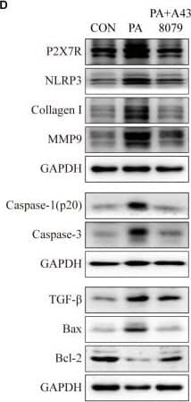 Western Blot: NLRP3/NALP3 Antibody - BSA Free [NBP2-12446] - The P2X7R inhibitor suppressed PA-induced inflammation, fibrosis & apoptosis in cardiomyocytes. (A) Cell viability was assessed by the CCK8 assay. H9c2 myocytes were incubated in a medium with A438079 at 0–80 μM for 12 h, & cells without A438079 treatment served as the control. (B) H9c2 myocytes were incubated in a medium with PA at 0–800 μM for 24 h, & cells without PA treatment served as the control. (C) Concentrations of IL-1 beta  in cell culture supernatants were detected by ELISA. (D) Representative Western blot analysis of P2X7R, NLRP3 inflammasome, collagen I, MMP9, TGF-beta , caspase-1, caspase-3, Bax, & Bcl-2. (E) The protein semiquantification is shown for P2X7R, NLRP3 & caspase-1. (F) The protein semiquantification is shown for collagen I, MMP9 & TGF-beta . (G) The protein semiquantification is shown for caspase-3, Bax, & Bcl-2. (H) The percentages of TUNEL-positive cells are shown. (I) Representative images of TUNEL stained H9c2 myocytes. CON, H9c2 myocytes without any treatment; PA, H9c2 myocytes treated with 200 μM PA for 24 h; PA + A438079, H9c2 myocytes pretreated with A438079 for 12 h, & then treated with 200 μM PA for 24 h. ∗p < 0.05 versus the CON group, #p < 0.05 versus the HFD group. Image collected & cropped by CiteAb from the following publication (//pubmed.ncbi.nlm.nih.gov/31681001), licensed under a CC-BY license. Not internally tested by Novus Biologicals.