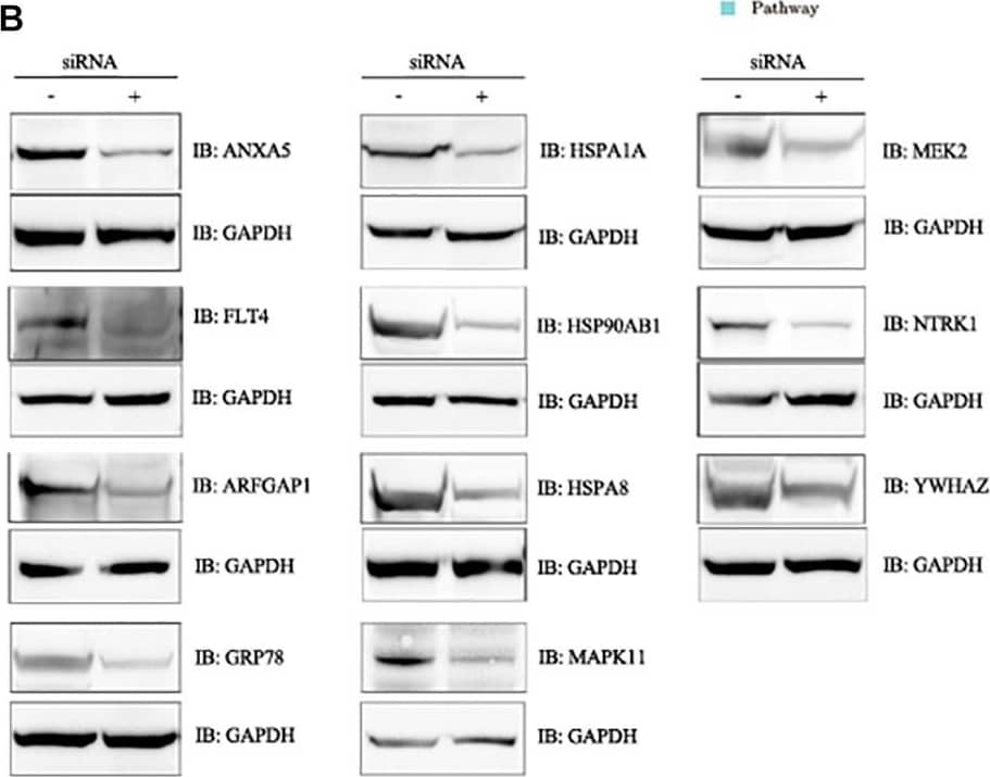 RNAi screening of host factors related to EBOV-trVLP life cycle and further validation and analysis. (A) RNAi silencing analysis of host factors required for the EBOV trVLP life cycle. A 100 μl sample of opti-MEM medium containing 1.4 μl siRNA and 4.5 μl HiPerFect was placed in 24-well plates, and a cell suspension (400 μl) containing 1 × 105 cells was added to give a final siRNA concentration of 75 nM. After incubation for 48 h, cells were infected with trVLPs for another 48 h, total RNA was extracted, and the absolute quantity of EBOV RNA was measured using a EBOV nucleic acid test kit. All qRT-PCR experiments were performed in triplicate and repeated three times independently. Cells not transfected with siRNA but infected with trVLPs served as a blank control; cells transfected with isotype siRNA and infected with trVLPs served as a negative control. Eleven siRNAs targeting HSPA1A, HSP90AB1, ARFGAP1, ANXA5, YWHAZ, MAPK11, NTRK1, FLT4, GRP78, MEK2, and HSPA8 inhibited trVLP replication effectively. ∗p < 0.05, ∗∗p < 0.01. (B) Western blot analysis of each target protein after siRNA transfection. The 11 target proteins were all expressed at much lower levels following transfection with the relevant siRNA. Normal 293T cells and cells transfected with isotype siRNAs served as controls. (C) Characterization of selected networks of candidate host proteins that may be important for regulating the trVLP life cycle. Interactions of the 11 host proteins were assessed using the GeneMANIA interaction database, and their functions were evaluated in association with cytoplasmic vesicle membranes, mitochondrial membranes, mitochondria, antigen binding, the COP9 signalosome, and phospholipid binding. Image collected and cropped by CiteAb from the following open publication (//pubmed.ncbi.nlm.nih.gov/30483236), licensed under a CC-BY license. Not internally tested by Novus Biologicals.