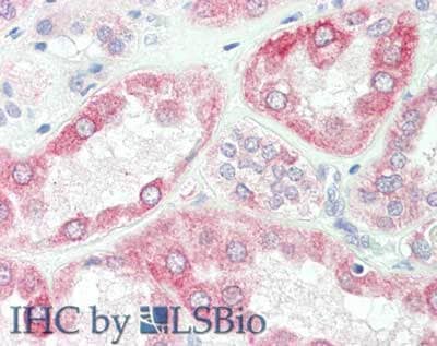 Immunohistochemistry of SPRY2 Antibody.  Tissue: kidney.  Fixation: formalin fixed paraffin embedded.  Antigen retrieval: not required. Primary antibody: Anti-sprouty 2 at 10 ug/mL for 1 h at RT. Secondary antibody: Peroxidase rabbit secondary antibody at 1:10,000 for 45 min at RT. Staining: Sprouty-2 as precipitated red signal with hematoxylin purple nuclear counterstain.