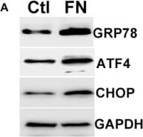 Western Blot: GADD153/CHOP Antibody - BSA Free [NBP2-13172] - Overexpression of extracellular fibronectin induces ER stress in primary human TM cells. (A) Primary human TM cells (n = 2 strains) were treated with cellular fibronectin (10 ug/ml) for 48 hours & cellular lysates were analyzed for ER stress markers. (B) Primary human TM cells (n = 2 strains) were treated with cellular fibronectin (10 ug/ml) for 48 hours & fixed cells were stained with fibronectin & KDEL antibodies. Cellular fibronectin increased extracellular fibronectin & ER stress in GTM3 cells (n = 2). Scale bar = 50 μm. (C) GTM3 cells were transduced with fibronectin activation lentiviral particles for 48 hours & stained with fibronectin & KDEL antibodies. Increased fibronectin expression alone is sufficient to induce ER stress in TM cells (n = 2). Scale bar  =  50 μm. Image collected & cropped by CiteAb from the following publication (//www.nature.com/articles/s41598-017-14938-0), licensed under a CC-BY license. Not internally tested by Novus Biologicals.