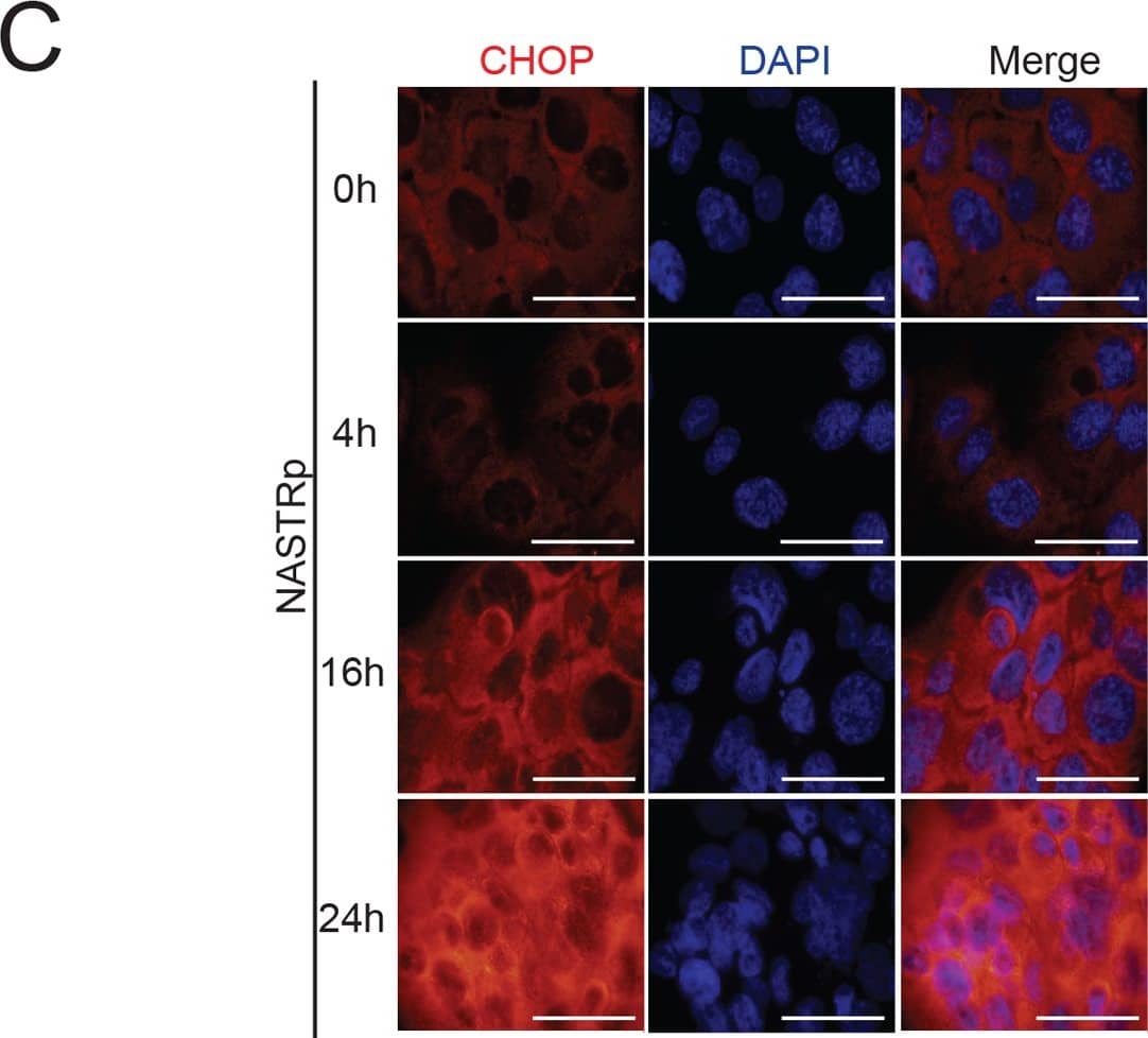 Immunocytochemistry/ Immunofluorescence: GADD153/CHOP Antibody - BSA Free [NBP2-13172] - NASTRp induces ER stress & eventually leads to cell death with Bim up-regulation.(A) qRT-PCR analysis of biomarkers of ER stress/UPR related genes in NCI-H441 treated with 20 μM NASTRp in time course manner. (B) NASTRp induced ER stress & activated UPR led to apoptosis with Bim induction in NSCLC cell lines. Cells were treated with the indicated concentrations of NASTRp for 24 hours & cell lysates were subjected to SDS-PAGE/Western blot analysis using the indicated antibodies. (C) Upregulation of CHOP by NASTRp. NCI-H441 cells were treated with 20 NASTRp for 0–24 hours. At the indicated time points, cells were fixed & subjected to immunofluorescence assay with anti-CHOP antibody. Cell images were microphotographed using fluorescence microscopy at 60X magnification. Scale bars: white; 10 μm. (D) TUNEL-positive cells in NASTRp-treated (for 48 hours) A549 cells were counted & analyzed as relative % of TUNEL-positive cells. *P < 0.05 versus vehicle. Image collected & cropped by CiteAb from the following publication (//dx.plos.org/10.1371/journal.pone.0122628), licensed under a CC-BY license. Not internally tested by Novus Biologicals.